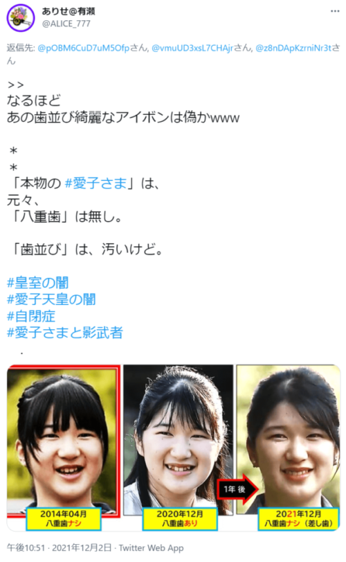 八重歯