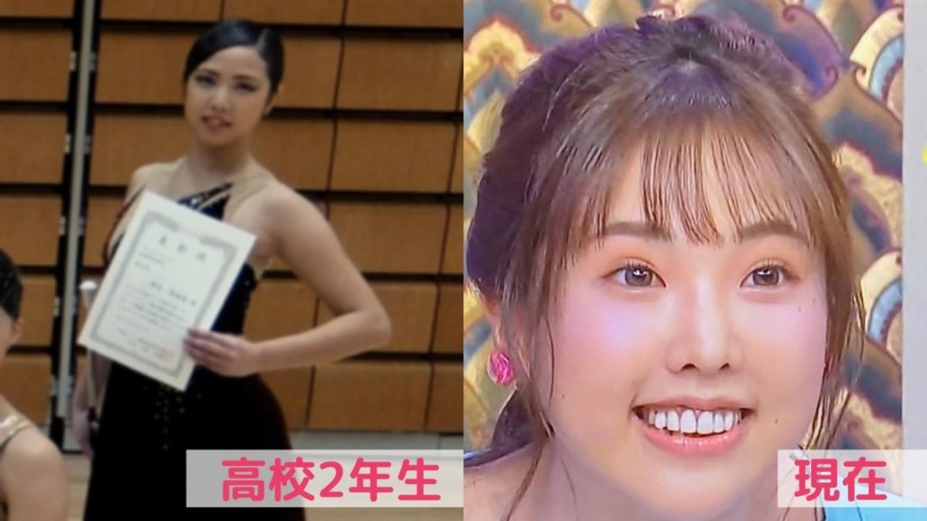 笹木里緒菜の鼻を画像で比較