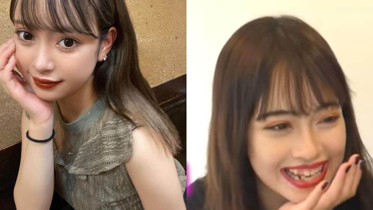 マリア愛子の歯並びがガタガタ?