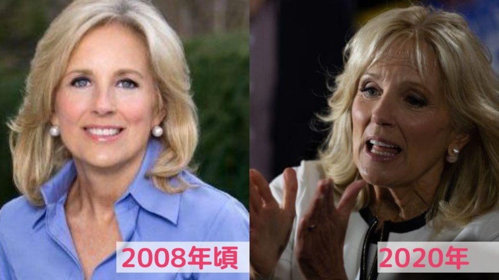 2008年頃と1980年代のジルバイデン夫人