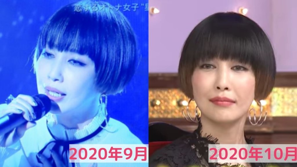 中島美嘉は自然にふっくらした?