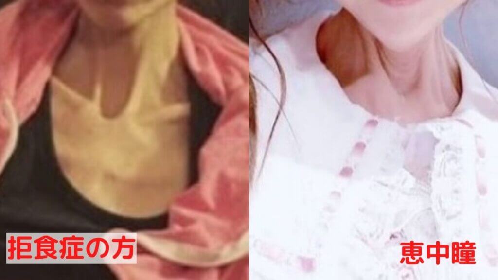 恵中瞳