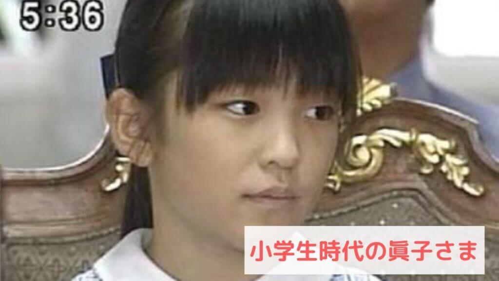 眞子さま、アヒル口
