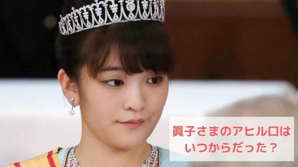 眞子さまのアヒル口はわざと?いつからなのか幼少期から画像で検証