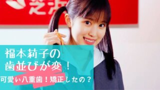 【画像】福本莉子の歯並びが変！八重歯は可愛いとの声も！矯正はしてる？